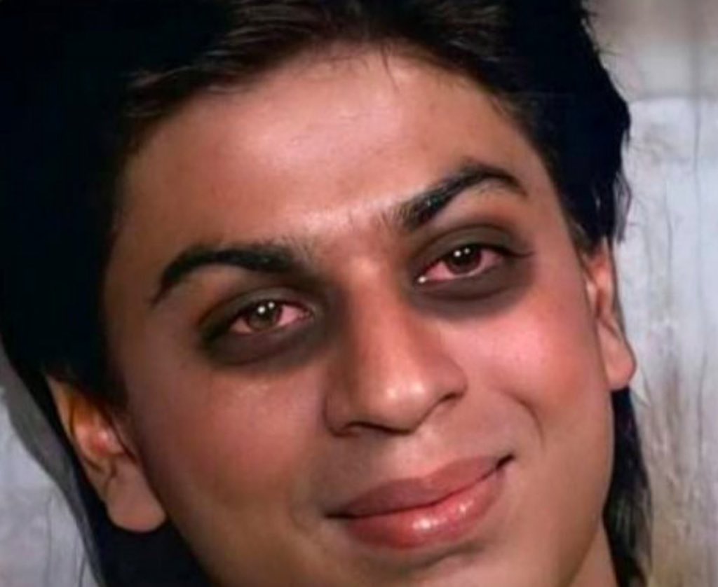 shah-rukh-khan-dark-circles.jpg